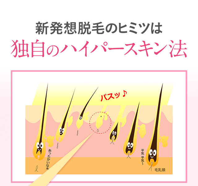 新発想脱毛のひヒミツは独自の「ハイパースキン法」